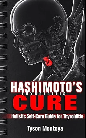 THYROID: Hashimoto's Thyroiditis Cure: Holistic Self-Care Guide for Thyroiditis (Self-Help Alternative Medicine Action Plan to Heal Hypothyroidism and ... issues) (Treating Thyroiditis Book 1)